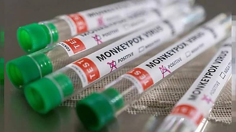 قرار مرتقب للصحة العالمية بشأن جدري القرود