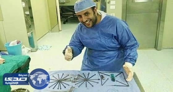 بالصور..طبيب يستخرج 39 مسمارا وولاعة وقصافة من معدة مريض