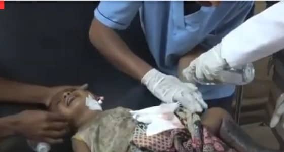 بالفيديو.. إصابة أب وطفلته إثر انفجار لغم حوثي في الحديدة