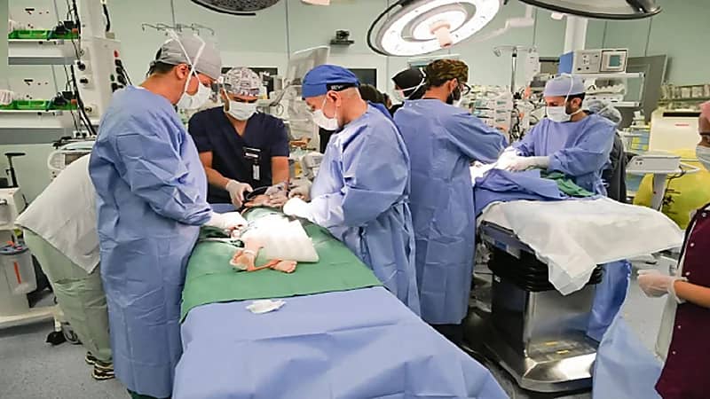 نجاح عملية فصل التوأم الملتصق السوري "سيلين وإيلين"