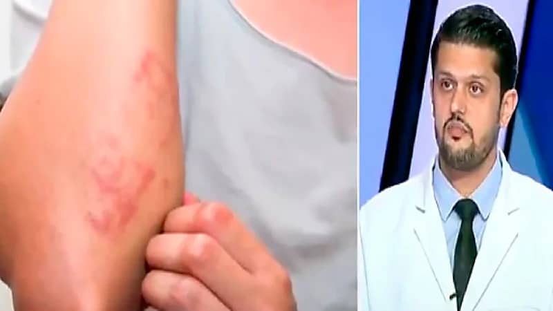 طبيب : "التان" يزيد من خطورة الإصابة بسرطان الجلد بشكل كبير