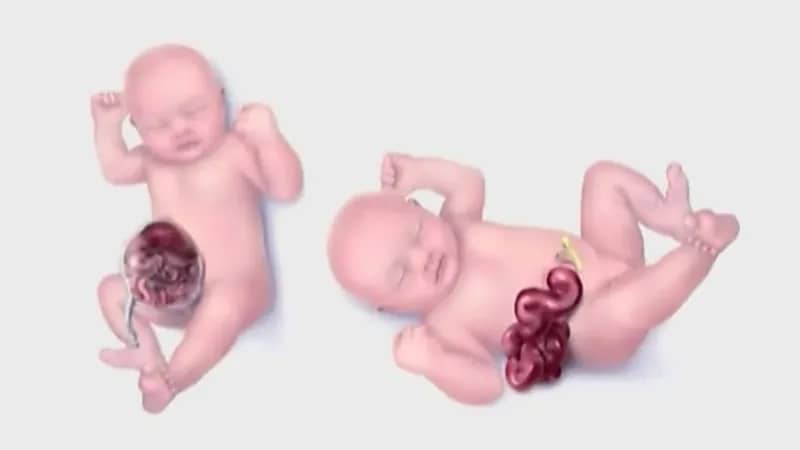 بالفيديو.. استشاري يوضح أبرز أسباب التشوهات الخلقية في الحمل ودور الأم فيها