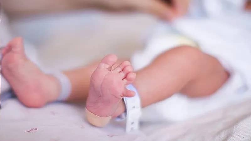 مصر تسجل ولادة طفلة في بطنها جنين