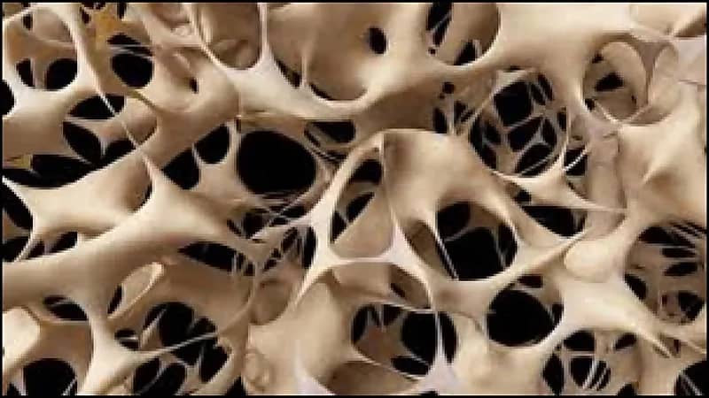 5 أطعمة تقي من هشاشة العظام