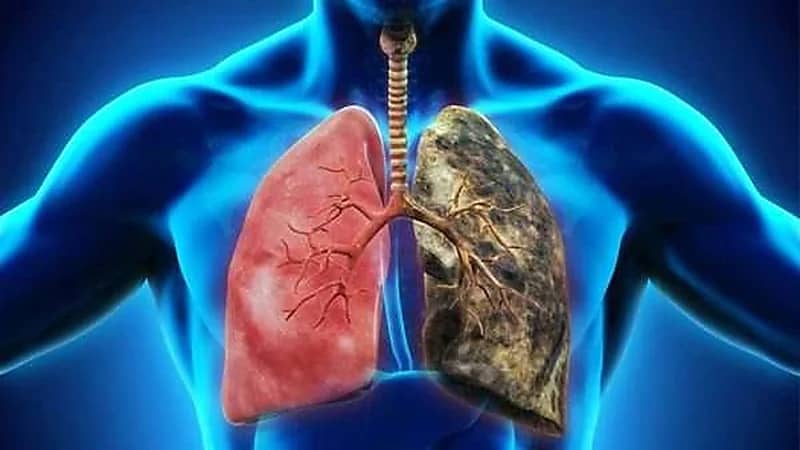 مقطع يحبس الأنفاس يكشف كيف تدمر السجائر الرئتين .. فيديو