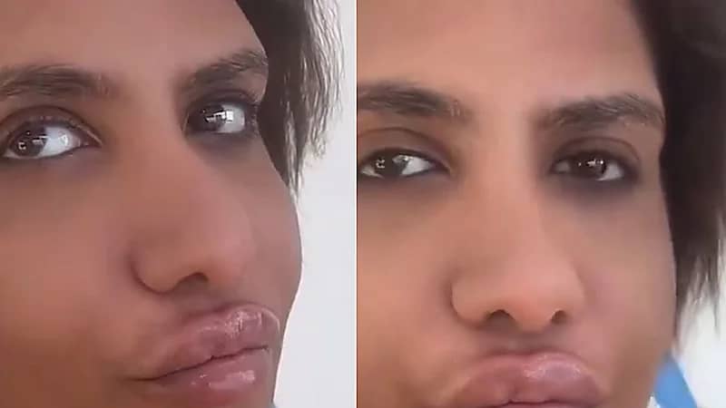 ريم البلوشي تشارك مقطع بعد إجرائها لعملية تجميل    .. فيديو