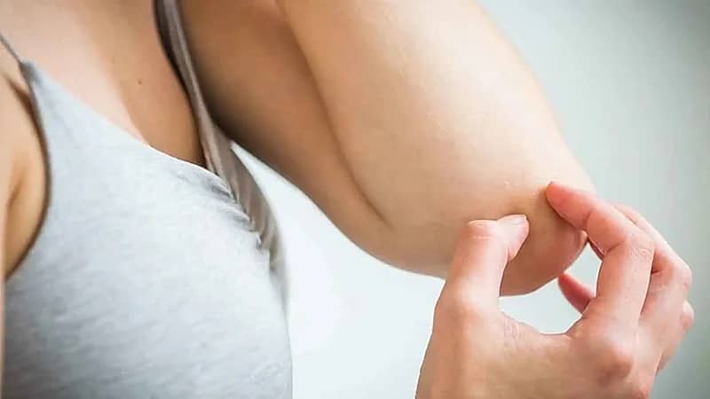 8 نصائح لتجنب الفطريات في الصيف