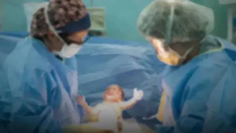 مصر تفرض معايير مشددة لتقليل الولادة القيصرية