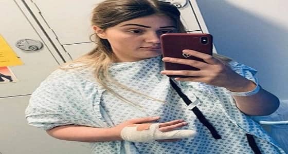 فتاة تفقد أصابعها بسبب الأظافر الاصطناعية