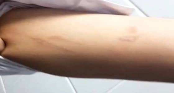  تفاصيل جديدة حول الطفلة المُعذبة على يد زوجة أبيها