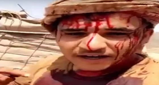 جنديان يقدمان أروع صور البطولة وينقذا زميلهما من شظية ليلقا استشهادهما