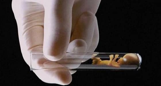 استشاري يكشف حقيقة مواجهة " أطفال الأنابيب " مخاطر كبيرة خلال المستقبل