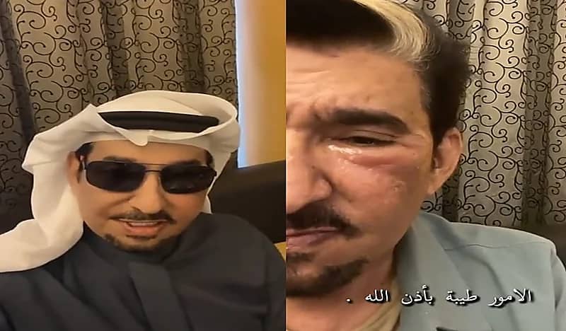 شاهد.. السدحان يصدم جمهوره بوجه منتفخ