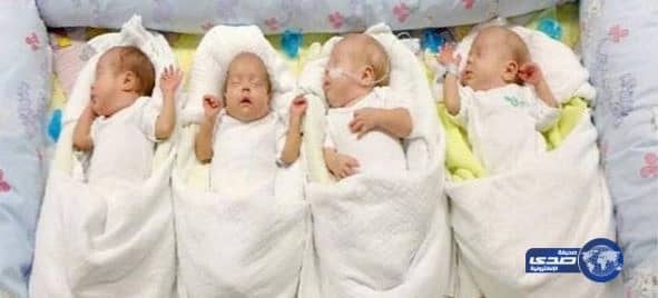 سيدة مصرية تنجب 4 توائم بتبوك