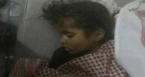 قناص حوثي يقتل طفلة يمنية شرق محافظة تعز جنوب البلاد