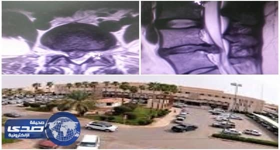 90 دقيقة في غرفة العمليات تعيد الحياة لثلاثينية بعنيزة