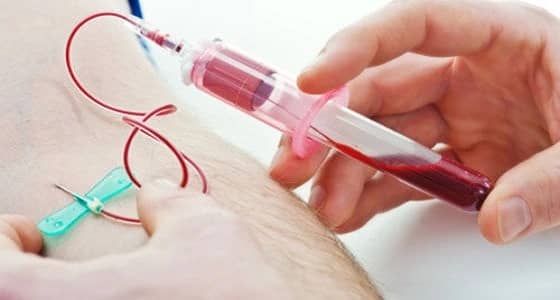 " الخضيري " يؤكد أهمية الكشف المبكر عن الأورام ويحذر من العواقب