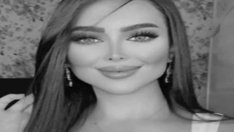 سوسن هارون تثير ضجة بين جمهورها بعد عملية التجميل الأخيرة 