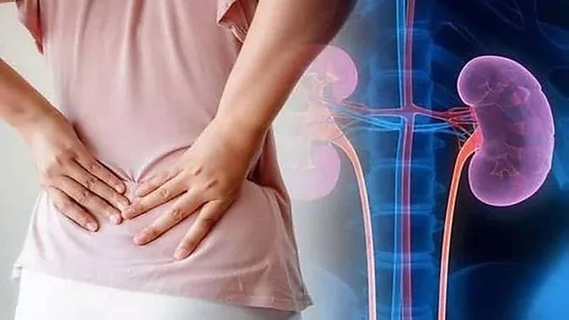 سبب إصابة النساء بأمراض الكلى بعد الثلاثين