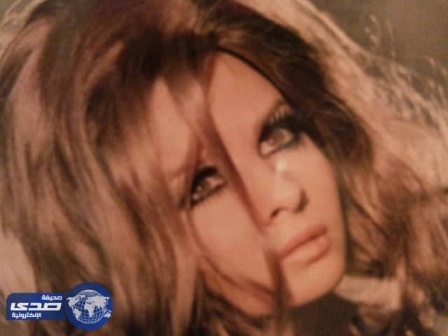 أصابة فنانة سورية في حادث سير خطير