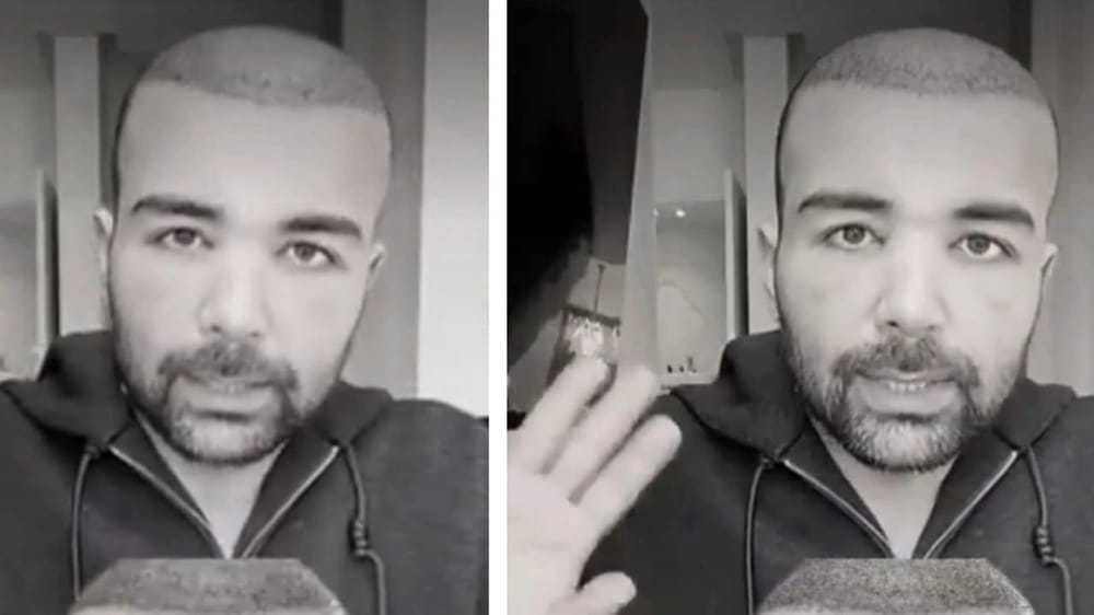 عقيل الرئيسي يطمئن جمهوره: الانتفاخ طبيعي بعد زراعة الشعر .. فيديو