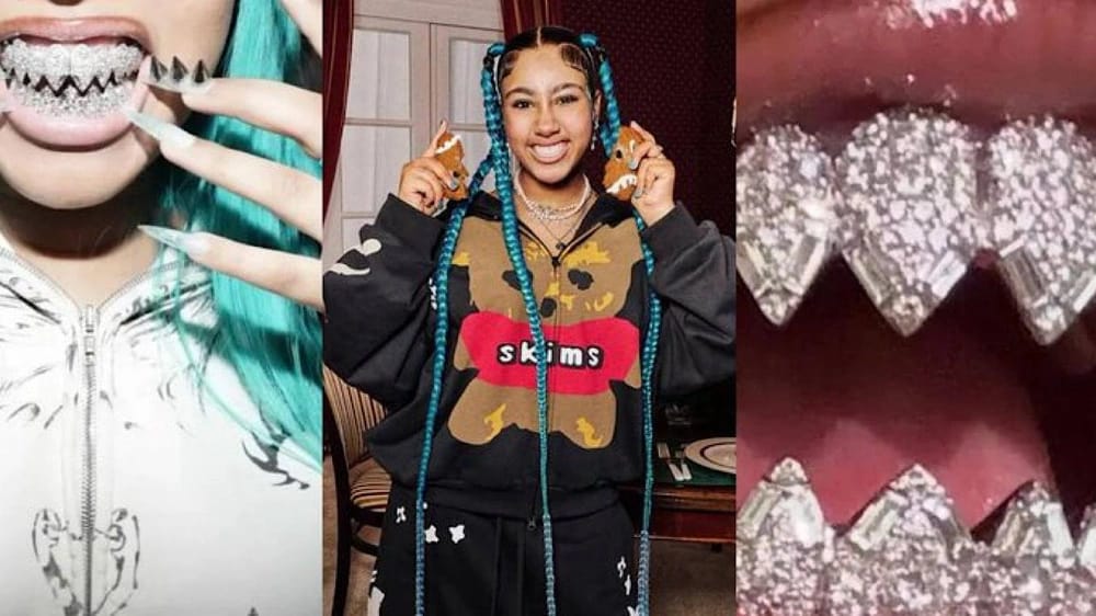 ابنة كيم كادراشيان تثير الجدل بأسنان مرصعة بالجواهر .. صور