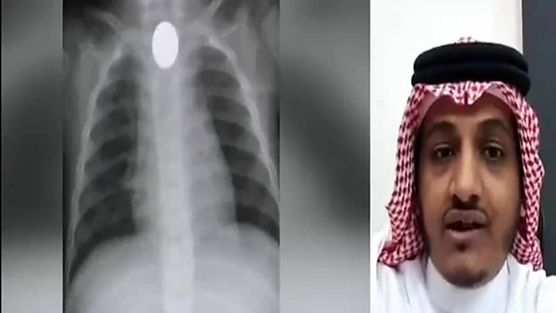 استشاري: تضاعفت نسب ابتلاع العملات الرقمية بعد تحويل العملات إلى معدنية