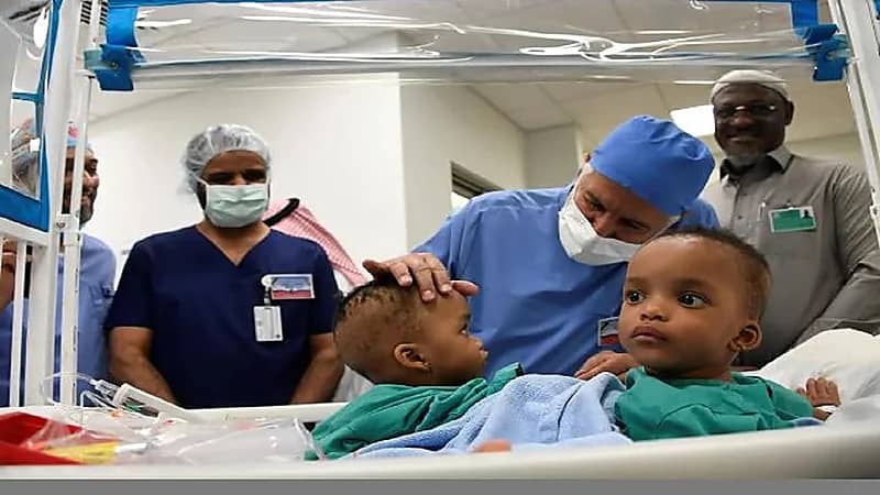 بدء عملية فصل التوأم السيامي النيجيري "حسانة وحسينة"