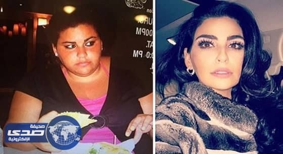 بالفيديو.. لبنانية تخسر 100 كيلو غرام .. والمئات يتبعون حميتها