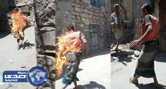 بالفيديو.. يمنيان يحرقان معاقا عقليا للتسلية والاستمتاع