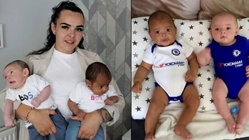 سيدة تنجب طفلين بلون بشرة مختلفة