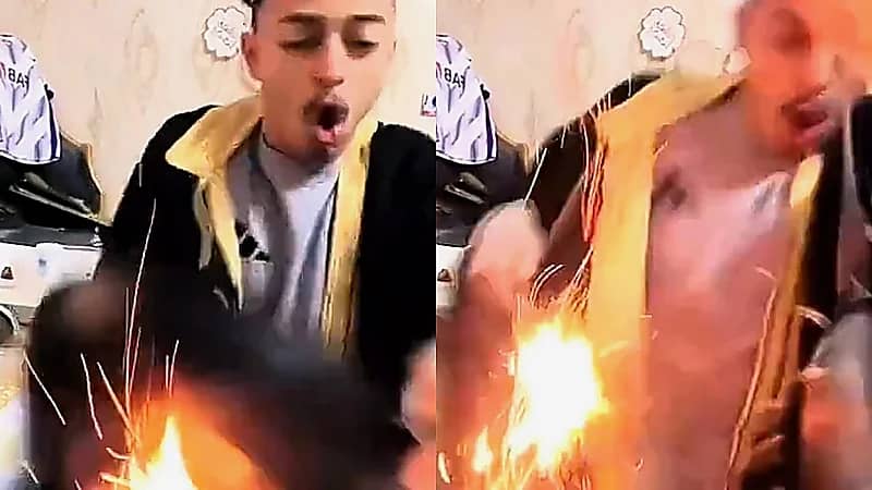 مشهد صادم لشاب ينسكب عليه الزيت المغلي أثناء البث .. فيديو