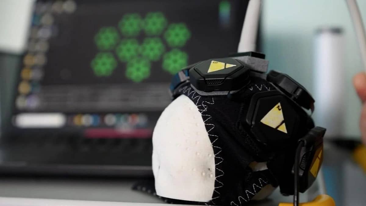 قبعة ذكية تتيح تشخيصًا مبكرًا لمشكلات الدماغ لدى الرضع