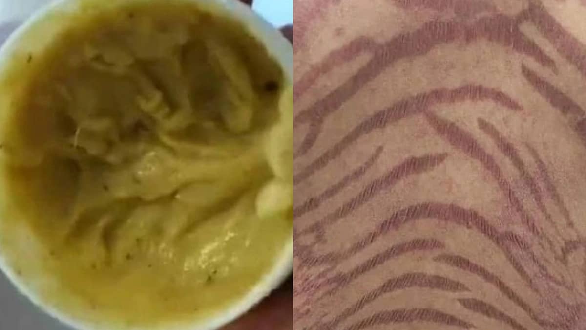 امرأة صينية تتحول بشرتها إلى ثعبان أرجواني بعد استخدام كريم لعشر سنوات