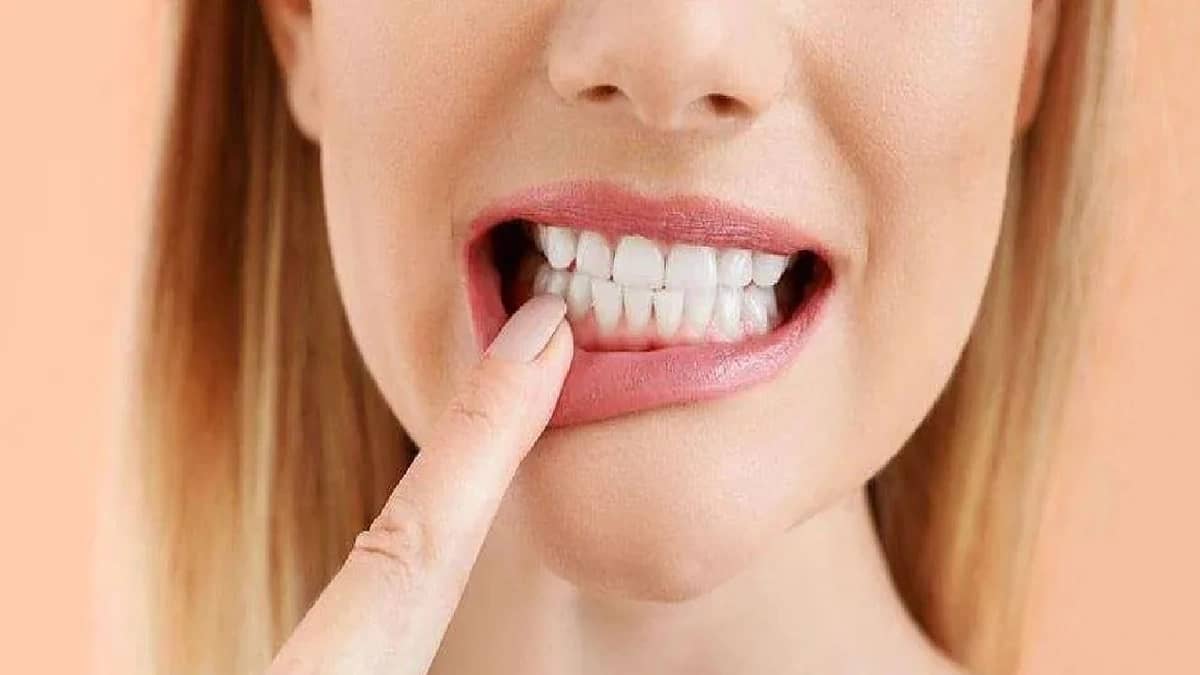 اكتشاف طريقة تعيد نمو مينا الأسنان